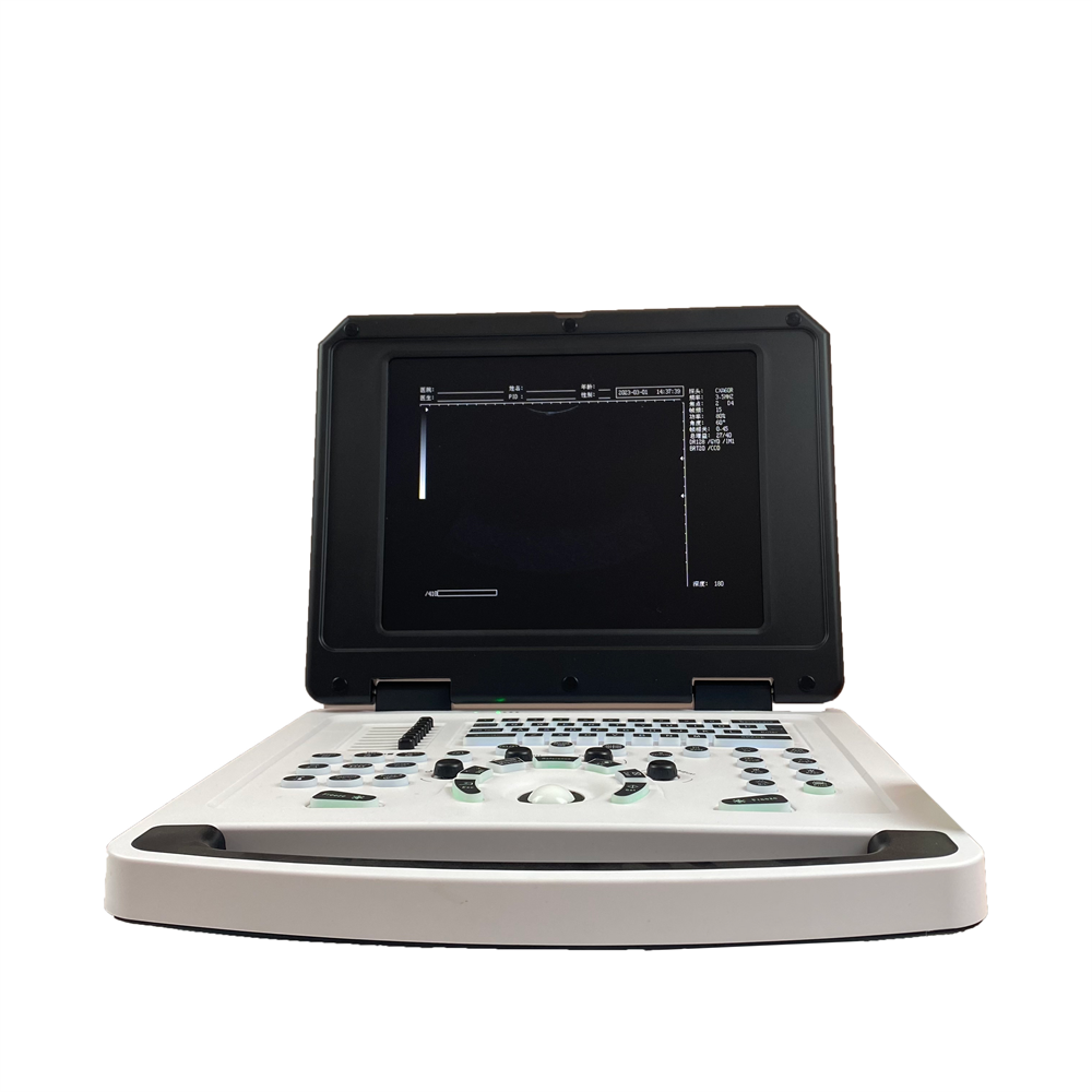 B ultrasound scanner