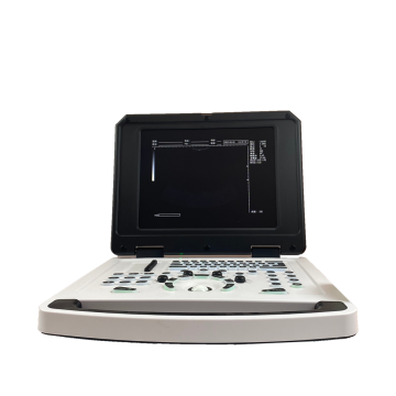Scanner de ultrassom de notebook barato e competitivo