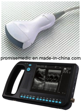 3.5 MHz Convex Transducer for Palmtop Digital Ultrasound Equipment (PRO-BCP300)