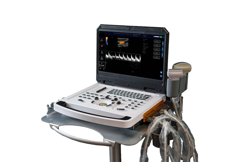 Sistema de diagnóstico Doppler em cores digitais completas para mama