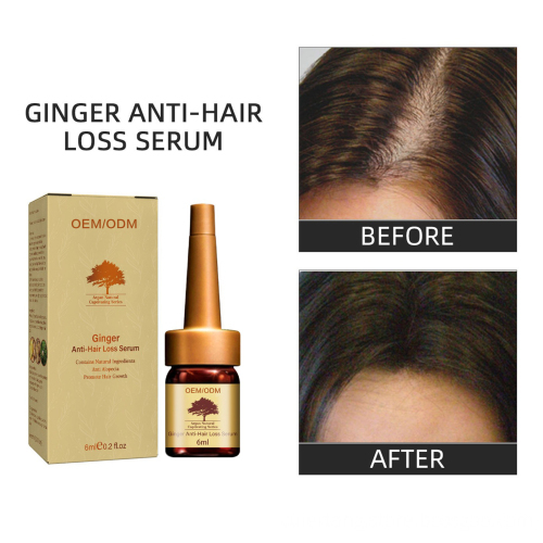 Top Selling Organic Ginger Hair Growth Serum: Your Solution for Strengthened, Repaired Hair Roots