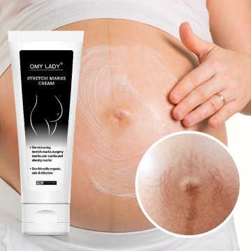 Omy Lady Custom Logo: 100% ασφαλές, υψηλής ποιότητας κατεστραμμένη επισκευή δέρματος &amp; τεντογραφικά σημάδια κρέμα απομάκρυνσης