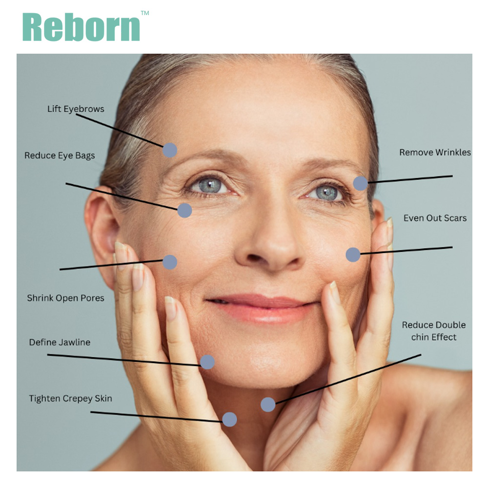 What parts of the body are suitable for Reborn PLLA