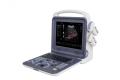 Bärbar 4D Cardiac Color Doppler Ultraljudsskanner