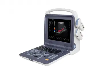 4D Portable Handheld Color Doppler Ultrasound Scanner