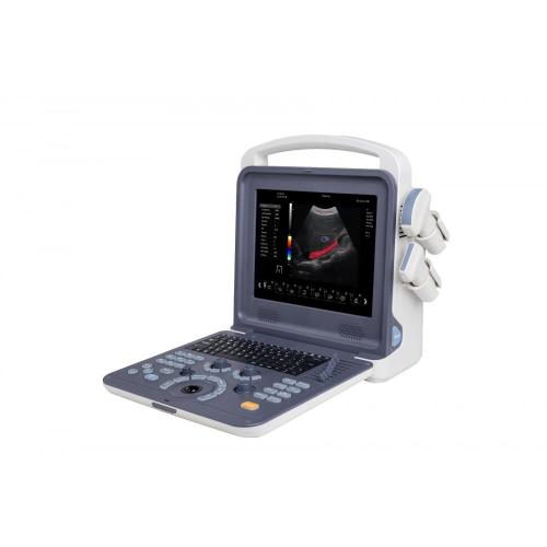 4D tragbarer tragbarer Farbdoppler-Ultraschallscanner