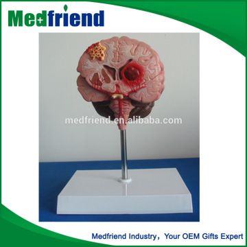 Medical Brain Anatomical Model for Education purpose/Use