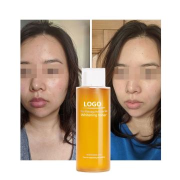 Organic Skin Care: Vitamin C and E Whitening, Brightening, and Moisturizing Toner for Face