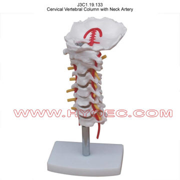 Cervical Vertebral Column with Neck Artery-J3C1.19.133