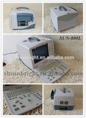 Mini Health Management Device/mini ultrasound device