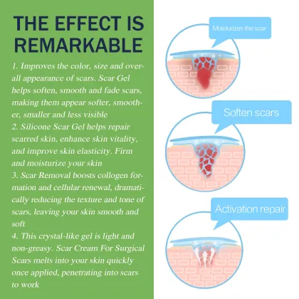 After Pregnancy Acne and Stretch Marks Repair Cream