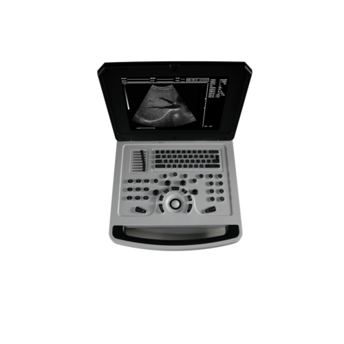 Ultrasound Machine Instrument Notebook Black And White Ultrasound Scanner for Cardiology Factory