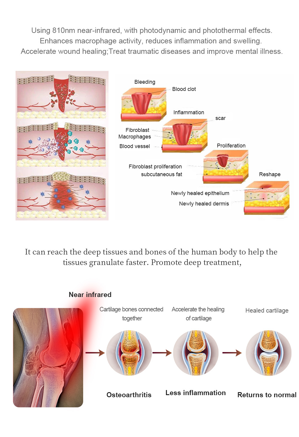 Light therapy bed (3)