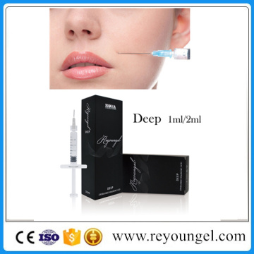 Injection Hyaluronic Acid Dermal Filler for Lips Fullness