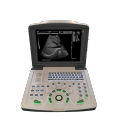 Portable digital black and white ultrasound scanner