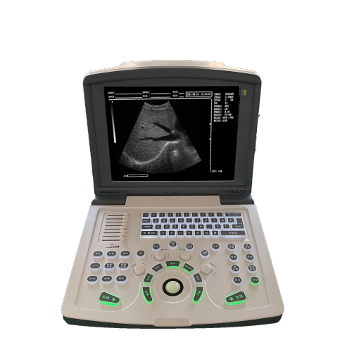 Portable digital black and white ultrasound scanner