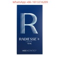 RADIESSE (+) 1.5ml プレフィルドシリンジ