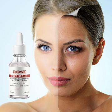 Good Molecule Discoloration Correcting Facial Essence with Rose Peptides for Skin Care and Dark Spot Removal