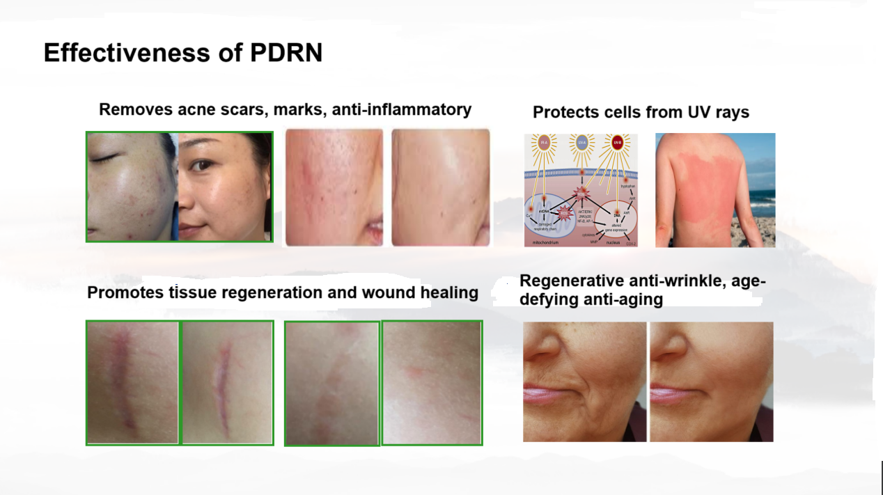 PDRN