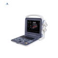 Color Doppler Ultrasound Scanner K2