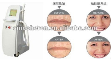 rf wrinkle removal machine