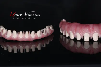 Sturdy zirconium oxide bridge frame