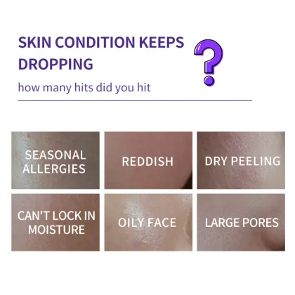 Best Moisturizing Facial Products for Sensitive Skin: Snail, Papaya, Lavender Acne Treatment Skin Care Set