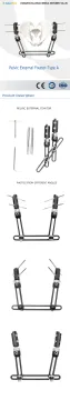 Pelvic Fragment External Fixator