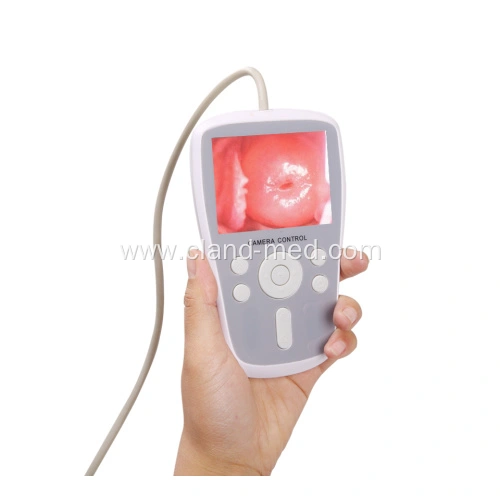 Perinav Camera Handheld Digital Full hd Camera for Vagina Colposcope China ...