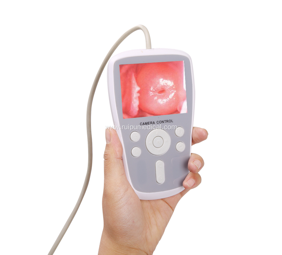 Handheld Digital Full hd Camera for Vagina Colposcope