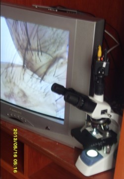 Video Microscope