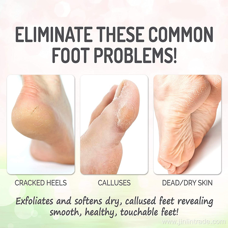 peeling foot treatment exfoliating foot mask peeling