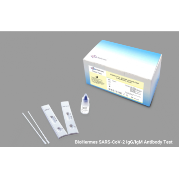 Novel Coronavirus Immunoglobulin M Test