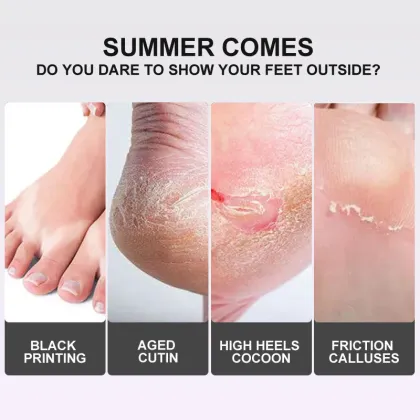 Lavender Foot Skin Care Mask for Dead Skin Removal