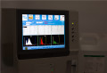 Medicinsk utrustning Auto Hematology Analyzer &amp; Reagens 3-Part