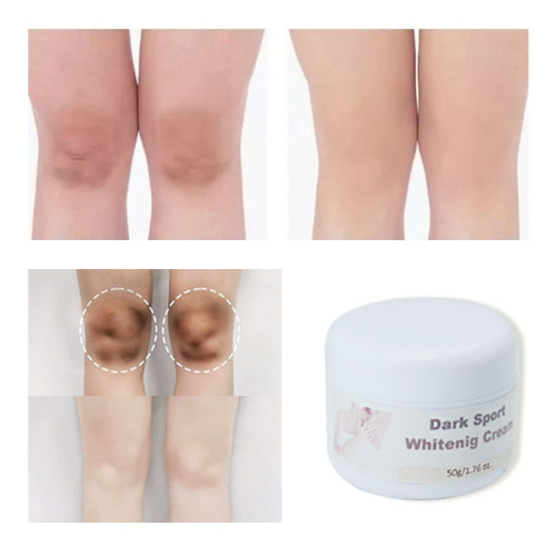 50 ml dunkle Knie und Ellbogen -Whitening -Blitzcreme