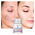 Colloidal Sulfur Acne Pimples Remover Yeast Essential