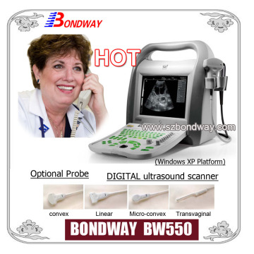 Digital Portable Ultrasound Diagnostic System (PC-based all-purpose Ultrasound)