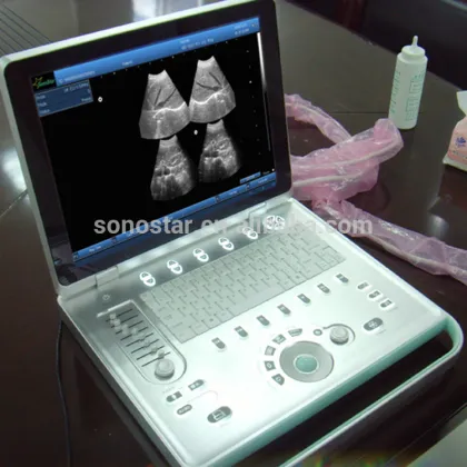 Sonostar Ultrasonic Diagnostic Devices Digital Portable Ultrasound Machine Price SS-9