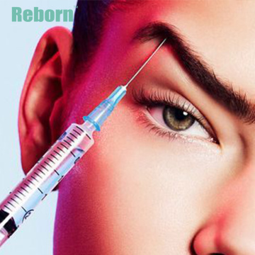 Tear trough correction dermal filler