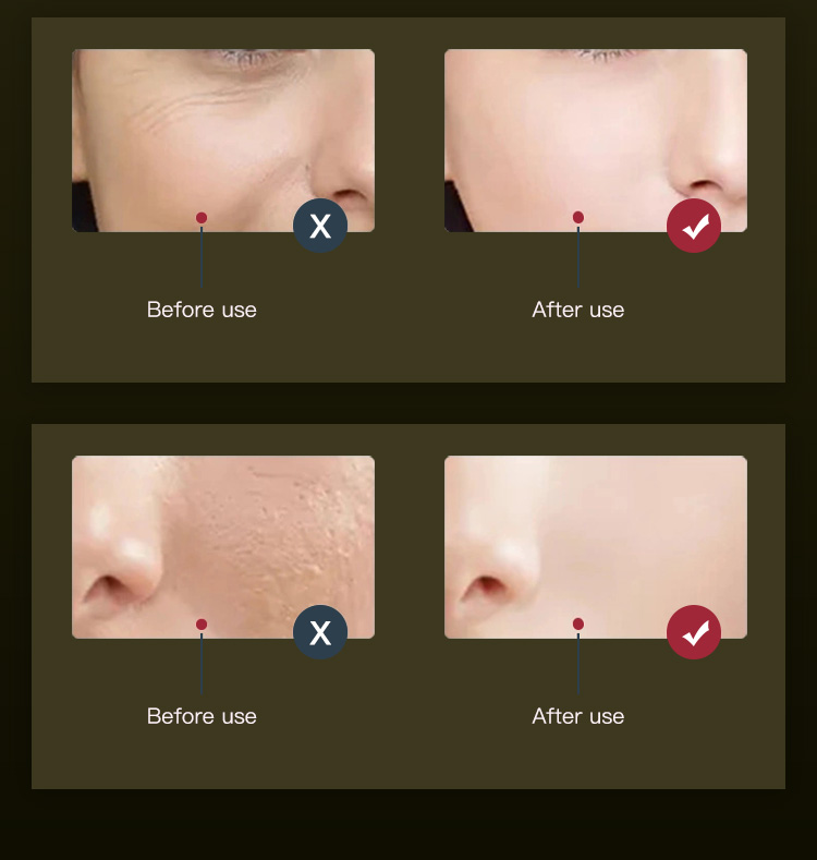 red face light therapy