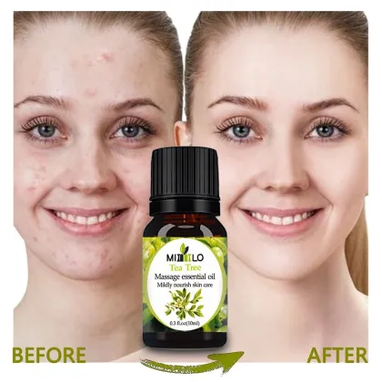 organic pure esensial oil tea tree essential oil