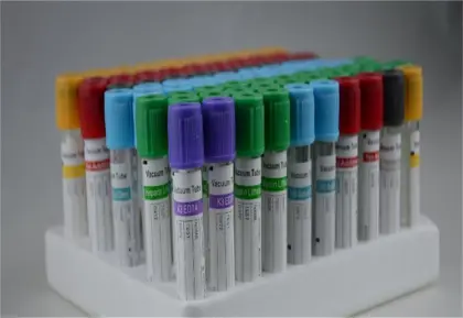 Anticoagulant vacuum blood collection test tube