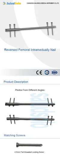 Reversed Femoral Nail Medical