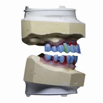 Implant Bridge, Feels Like Your Own Teeth