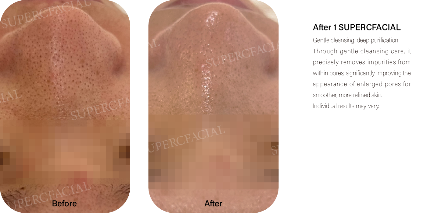 الرؤوس السوداء