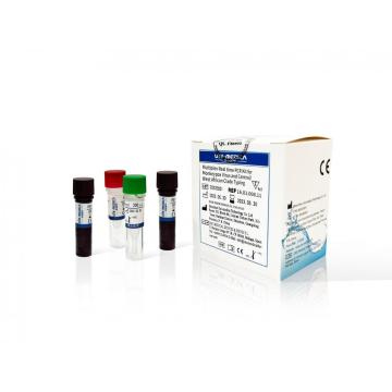 Kit PCR in tempo reale multiplex per virus Monkeypox e digitazione del clade dell&#39;Africa centrale/occidentale