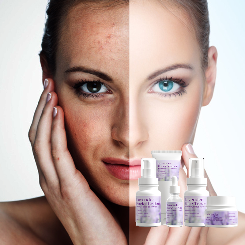 Lavender Skin Care Set: Custom Wholesale Toner, Lotion, and Cream for Moisturizing and Repairing Dry Skin