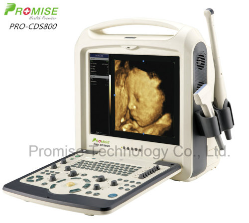 Laptop-Sized Color Doppler Diagnostic System (PRO-CDS800)