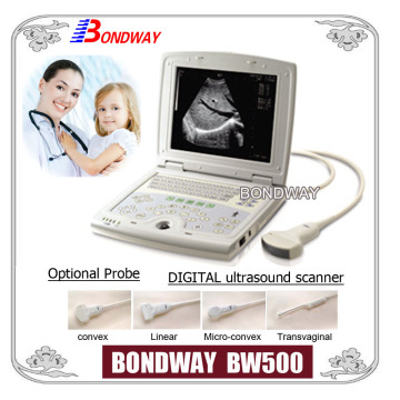 Laptop Ultrasound Scanner, Ultrasounds Sonography Diagnostic Ultrasound Ultrasound Imaging (BW500)